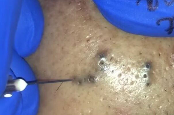 Using Learning Data to Reduce Dropout Rates