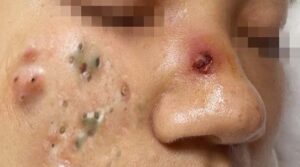 Drink Patterns That Support Natural Detox