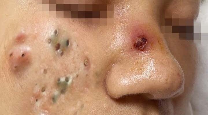 Drink Patterns That Support Natural Detox