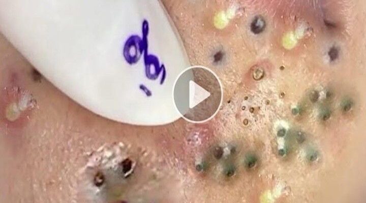 Toxin Free Foods to Bring Variety Into Your Meals