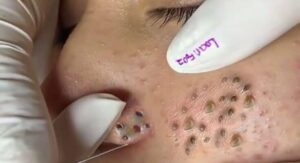 Data-Driven Online Lesson Improvements