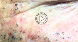 Data-Driven Online Lesson Improvements