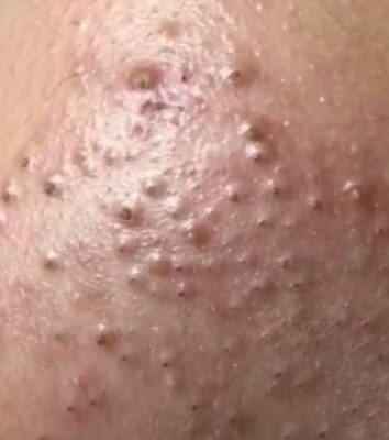 Data-Driven Online Lesson Improvements